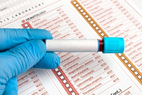 Proteina C Reattiva O Pcr Cos E I Valori Quando E Alta O Bassa Cause Sintomi