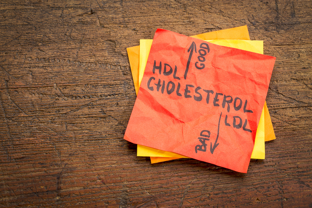 colesterolo Foto Di marekuliasz shutterstock_643210681
