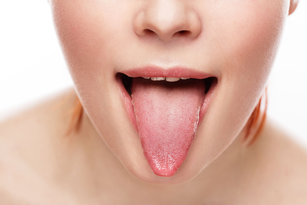 Colore della lingua e porblemi di salute | Foto Irina Bg Shutterstock