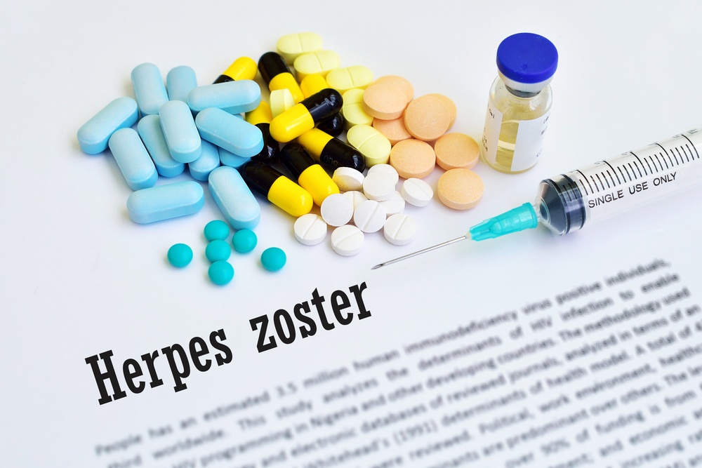 herpes zoster ictus