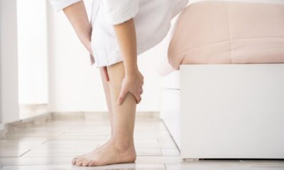 Vene varicose: come prevenirle con le calze elastiche